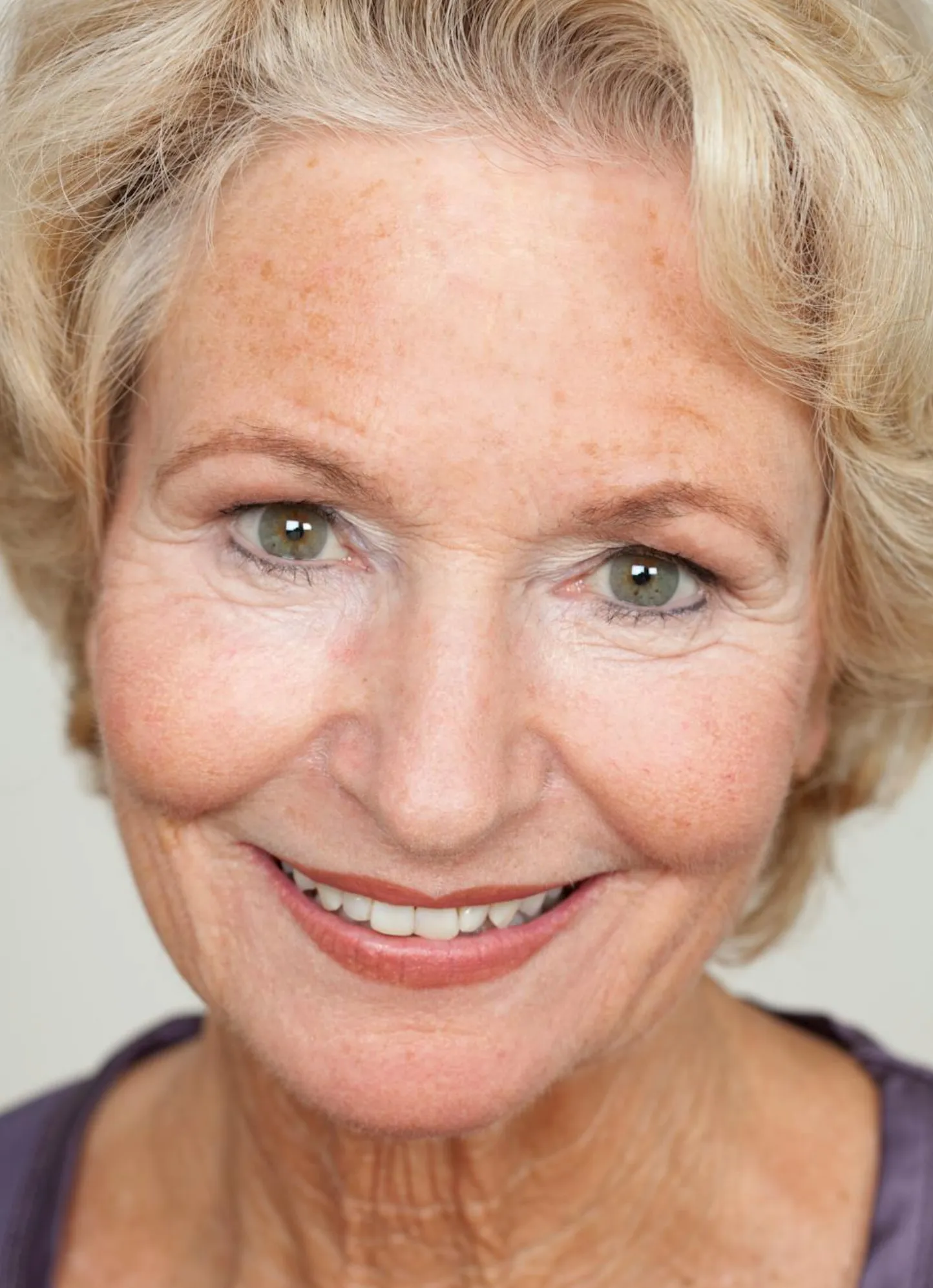 Sun spots and freckles